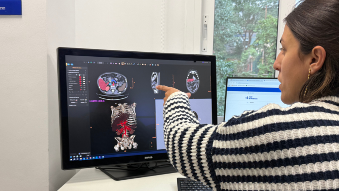 Unitat de Tecnologies 3D de Vall d’Hebron