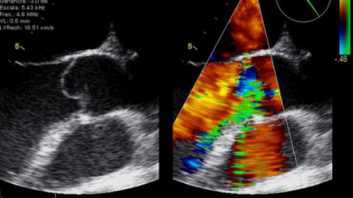 Curs Teòric-pràctic d’Ecocardiografia Bàsica i d’Ecocardiografia Avançada en Medicina Intensiva, Anestèsia i Reanimació 