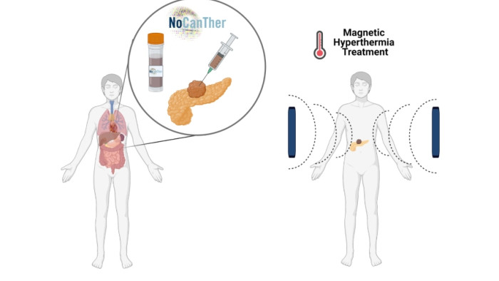 Estudi Clínic nanopartícules 