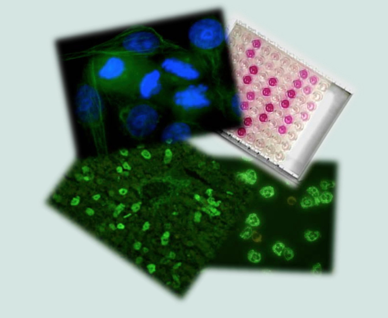 Autoimmunitat