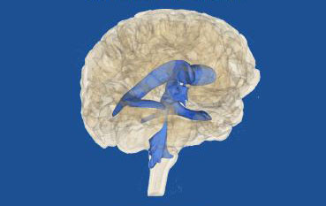 Cervell