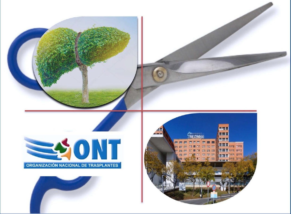 ONT