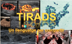 Tirads
