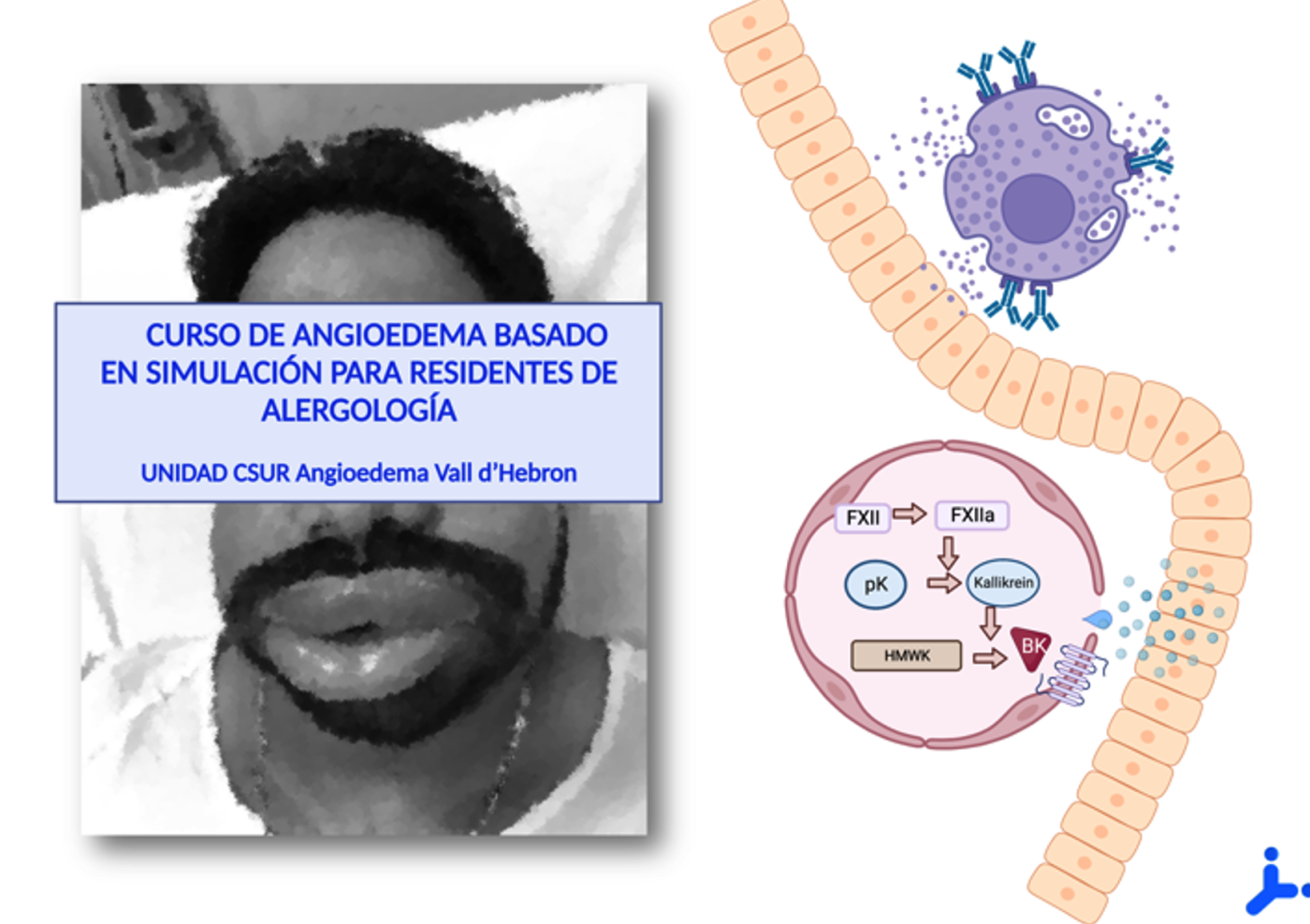 Portada angioedema residents