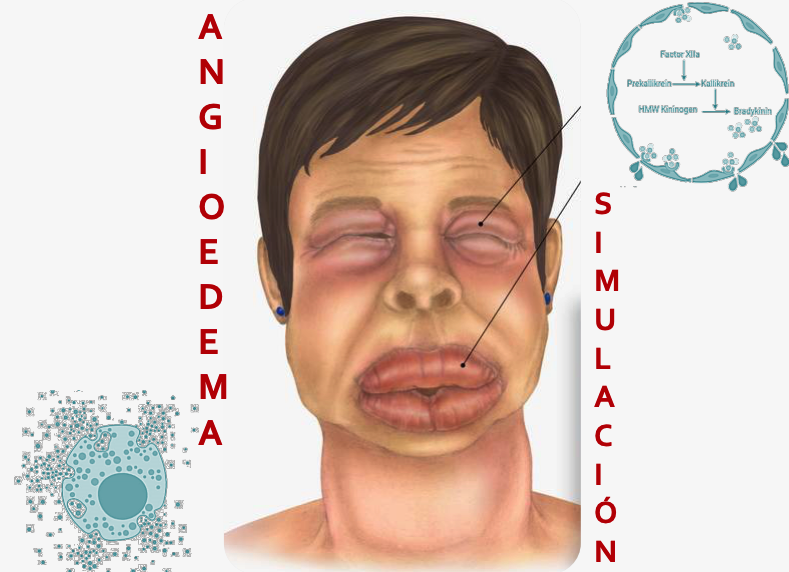 Portada del curs d'angioedema