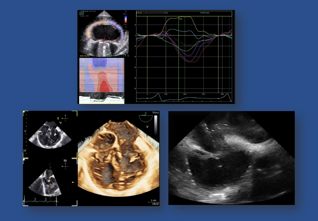 Ecocardio Pediátrica