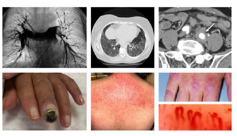 portada enfermedades sistemiques