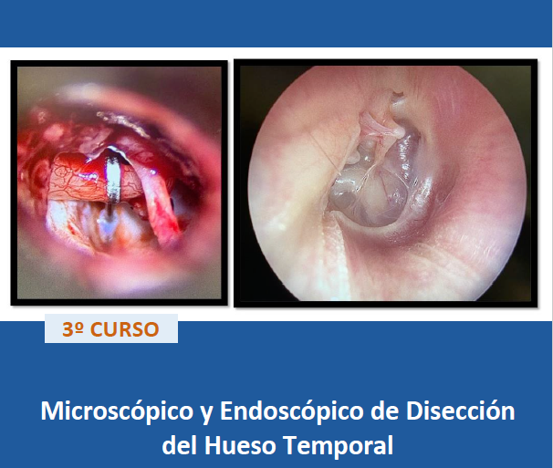 261001- programa- microscopico-endoscopico-diseccion-hueso-temporal