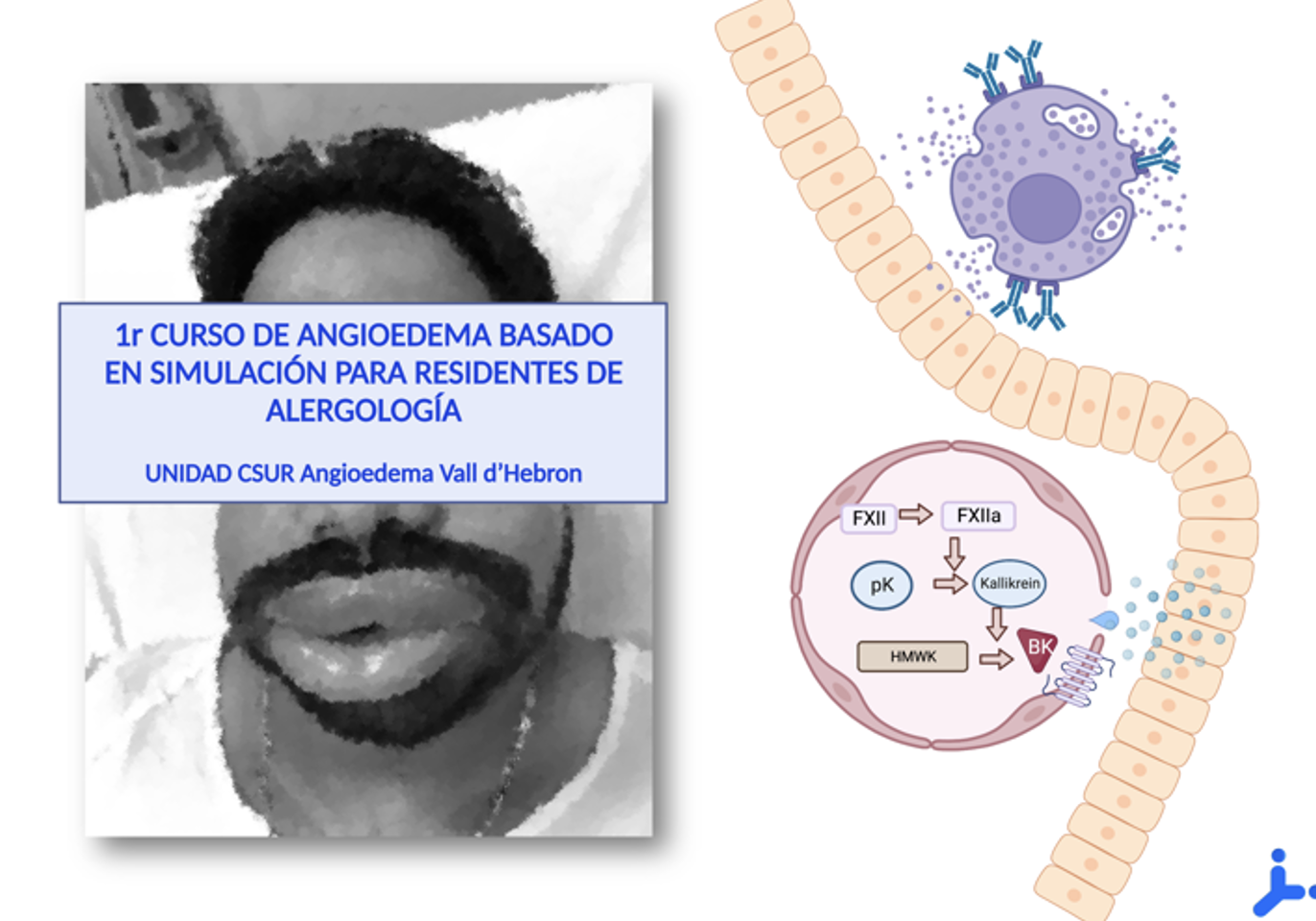 261202-portada-angiodema